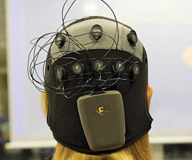 Electric Brain Stimulation