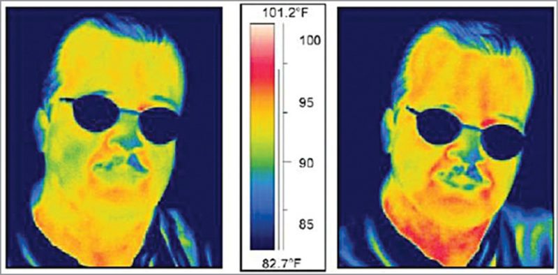 Facial thermographs, a biometric technology likely to become popular in the near future (Image courtesy: http://biometrics.mainguet.org)
