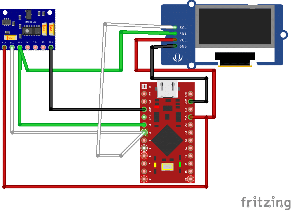 COVID -19 Ventilator and Health Monitoring Device | Full DIY Project