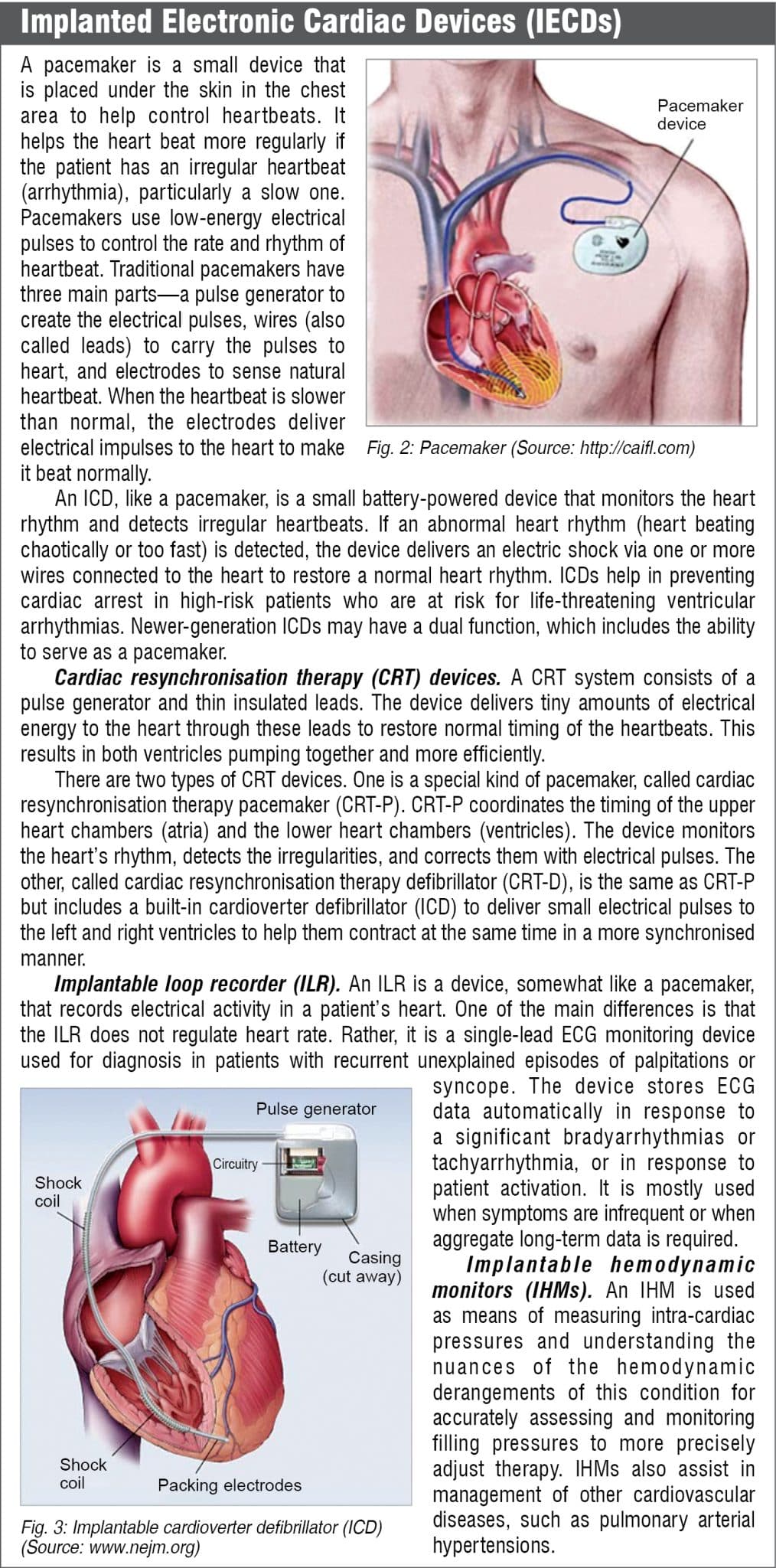 Remote Monitoring Of Cardiac Devices